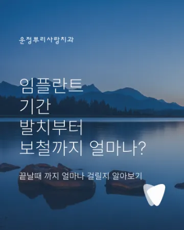 임플란트 기간, 발치부터 보철까지 얼마나 걸릴까요?