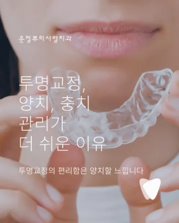 투명교정 - 양치, 충치 관리가 더 쉬운 이유