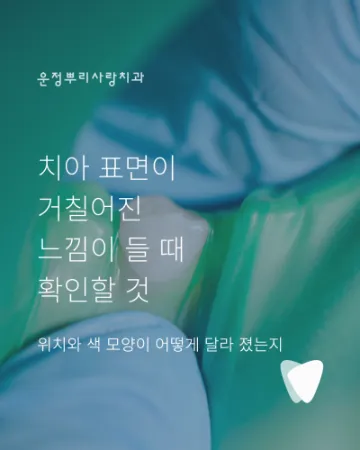 치아 표면이 거칠어진 느낌이 들 때 확인할 것