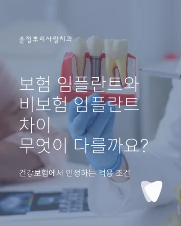 보험 임플란트와 비보험 임플란트 차이, 무엇이 다를까요?