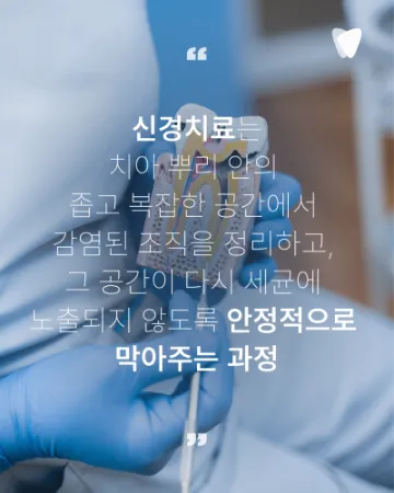 신경치료는 왜 여러 번 받아야 할까요? 한 번에 끝나지 않는 이유