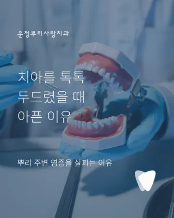치아를 톡톡 두드렸을 때 아픈 이유, 뿌리 주변 염증을 살피는 이유