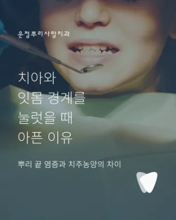 치아와 잇몸 경계를 눌렀을 때 아픈 이유, 뿌리 끝 염증과 치주농양의 차이