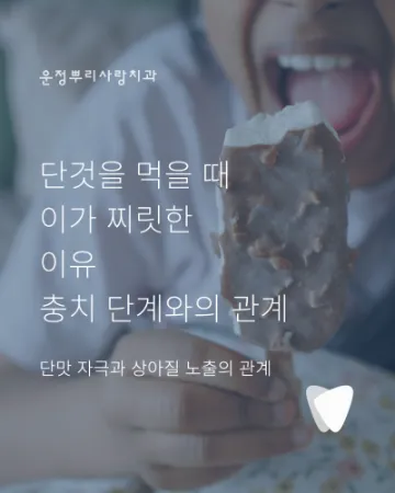 단것을 먹을 때 이가 찌릿한 이유, 충치 단계와 관련 있을까요