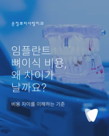 임플란트 뼈이식 비용, 같은 뼈이식인데 왜 다를까요?